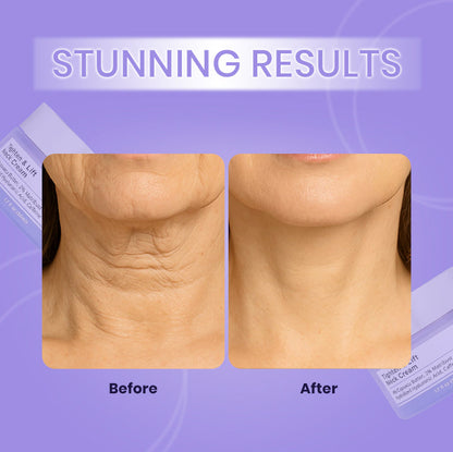 Premium Neck Firming & Lifting Cream | Anti-Wrinkle & Hydrating